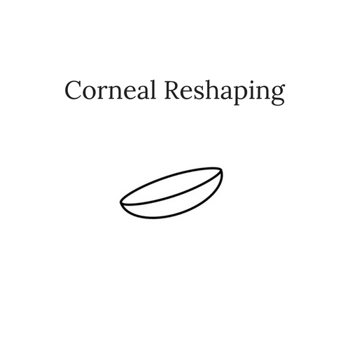 Corneal Reshaping